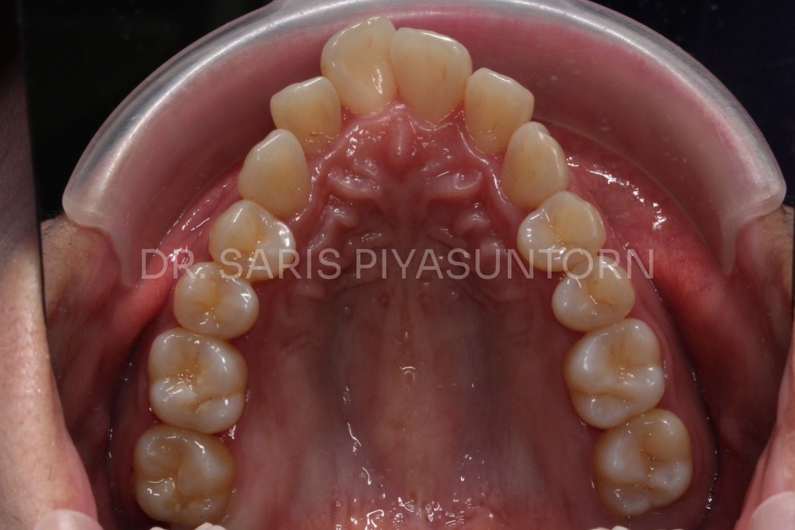 Before image