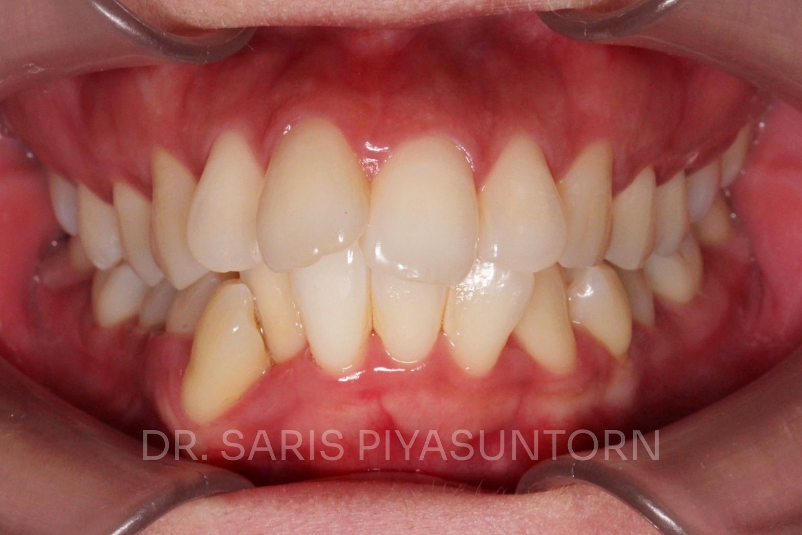 Before image