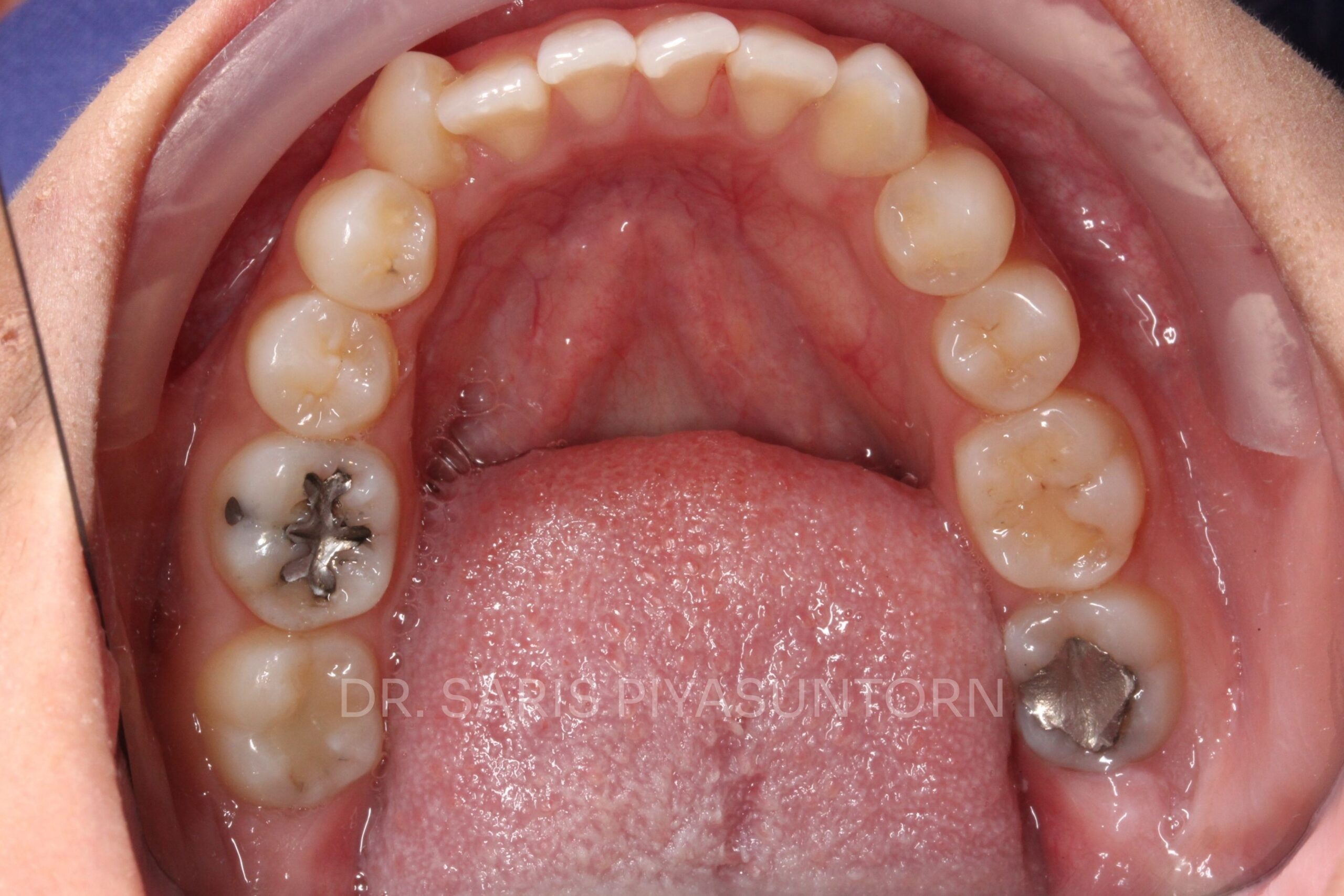 Before image