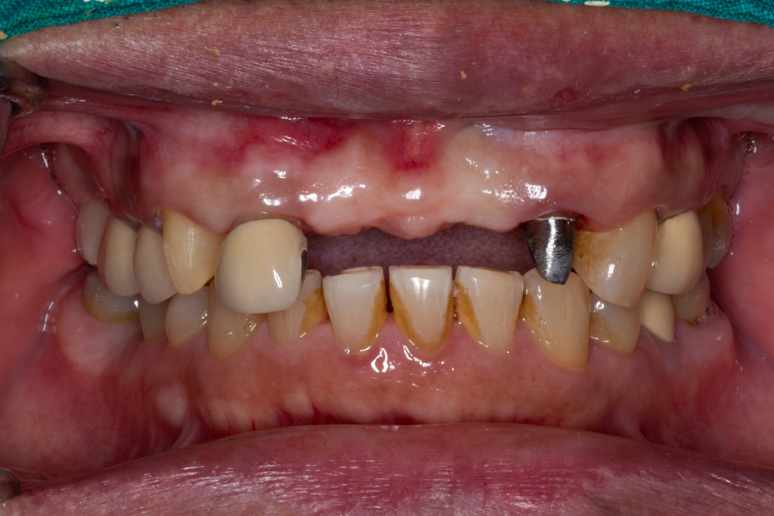 Before image