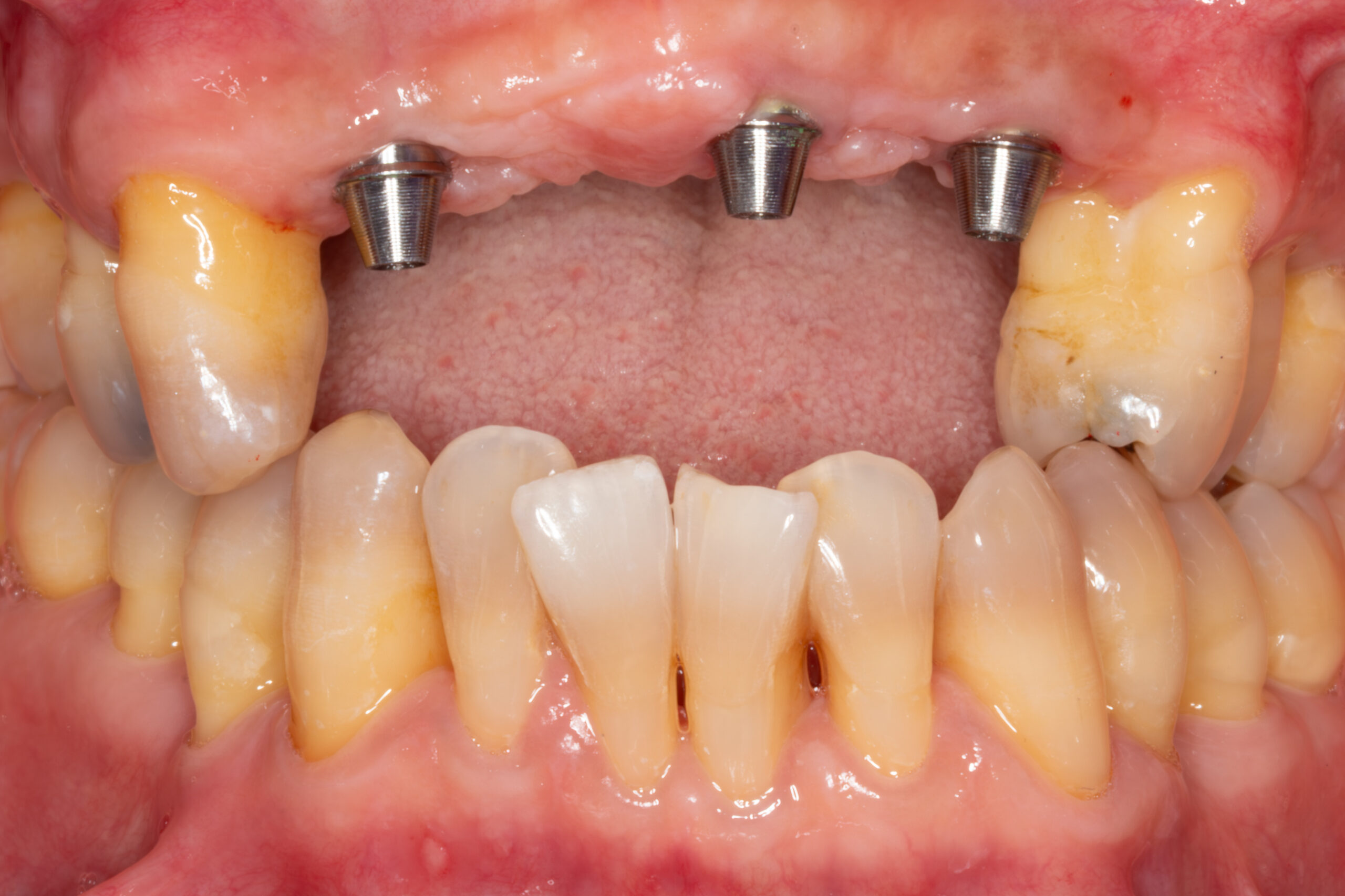 Before image