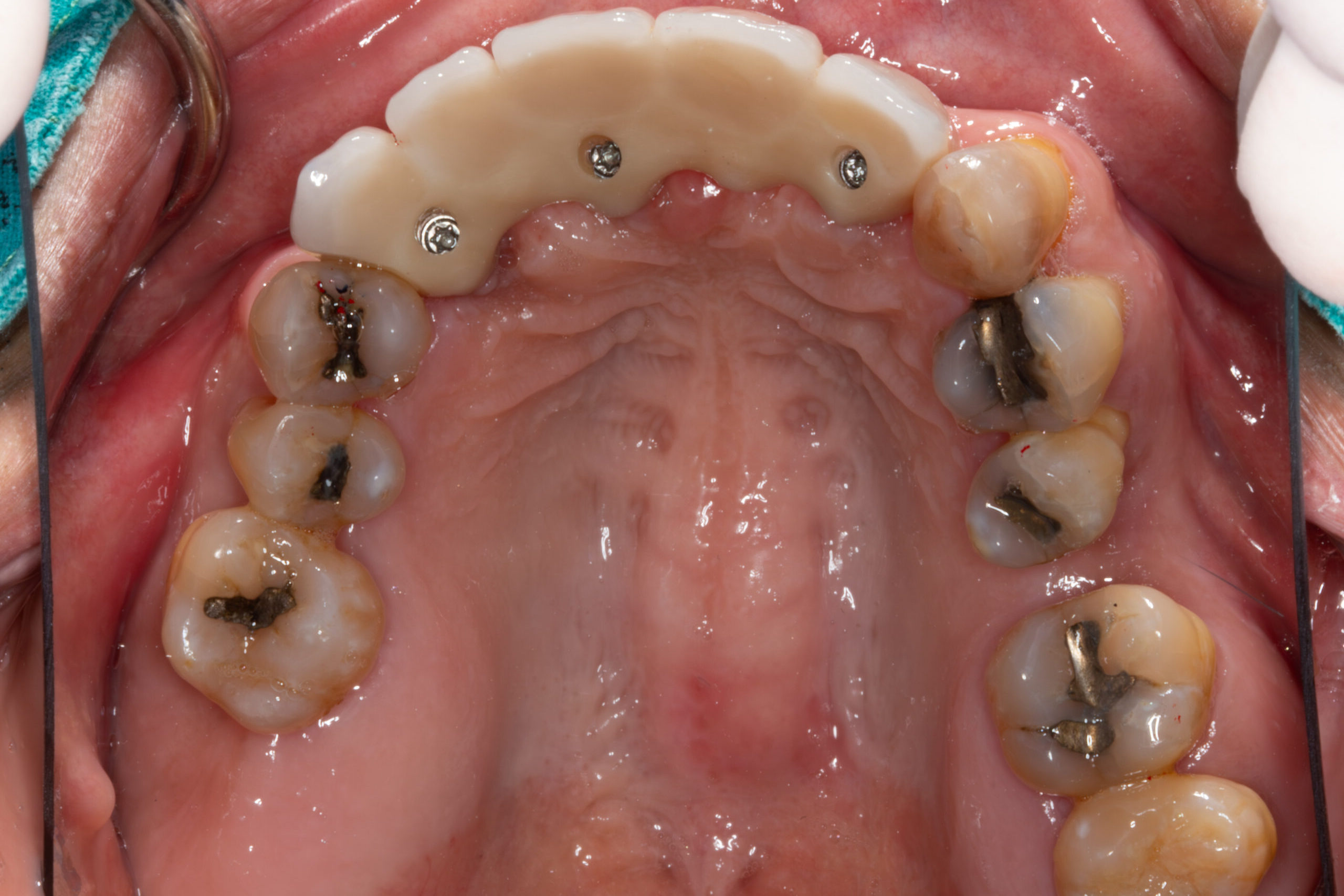 After image
