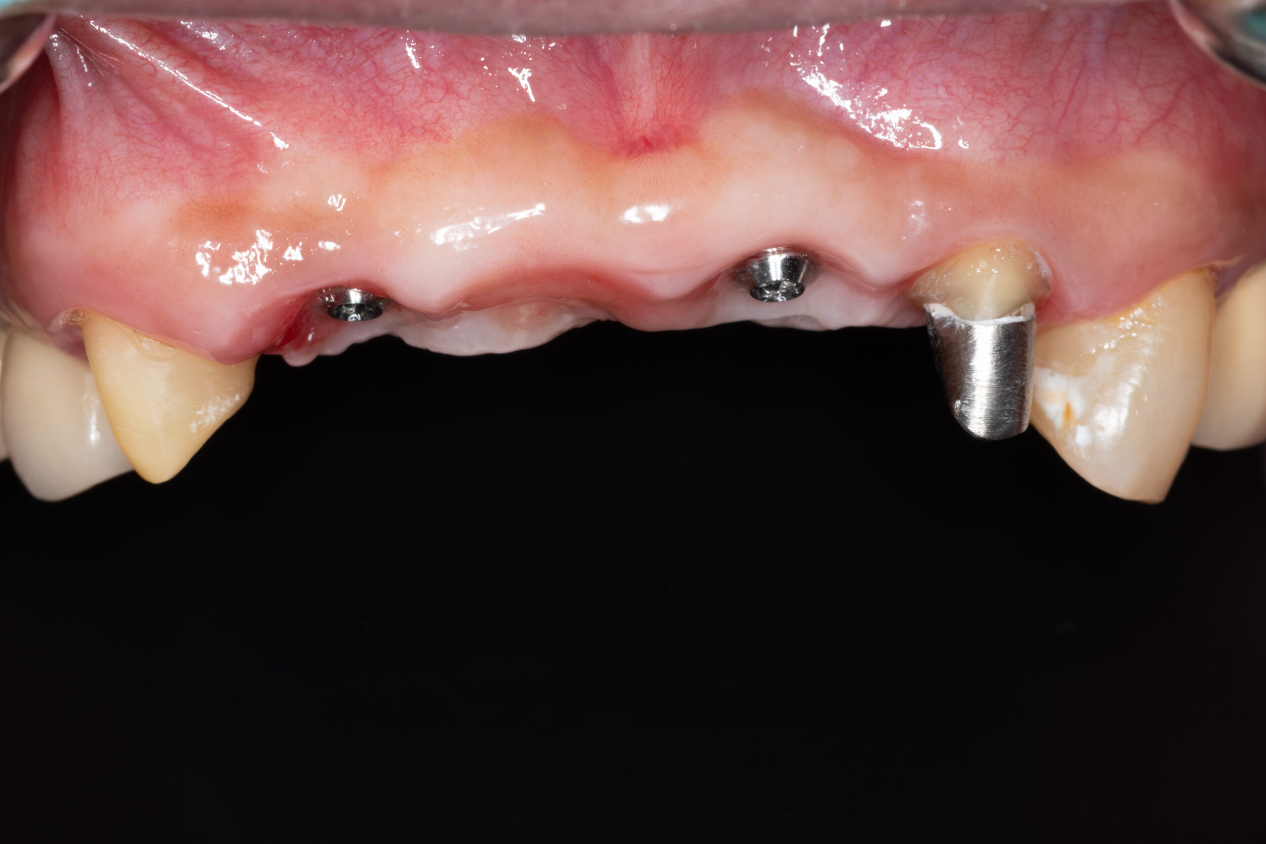 Before image