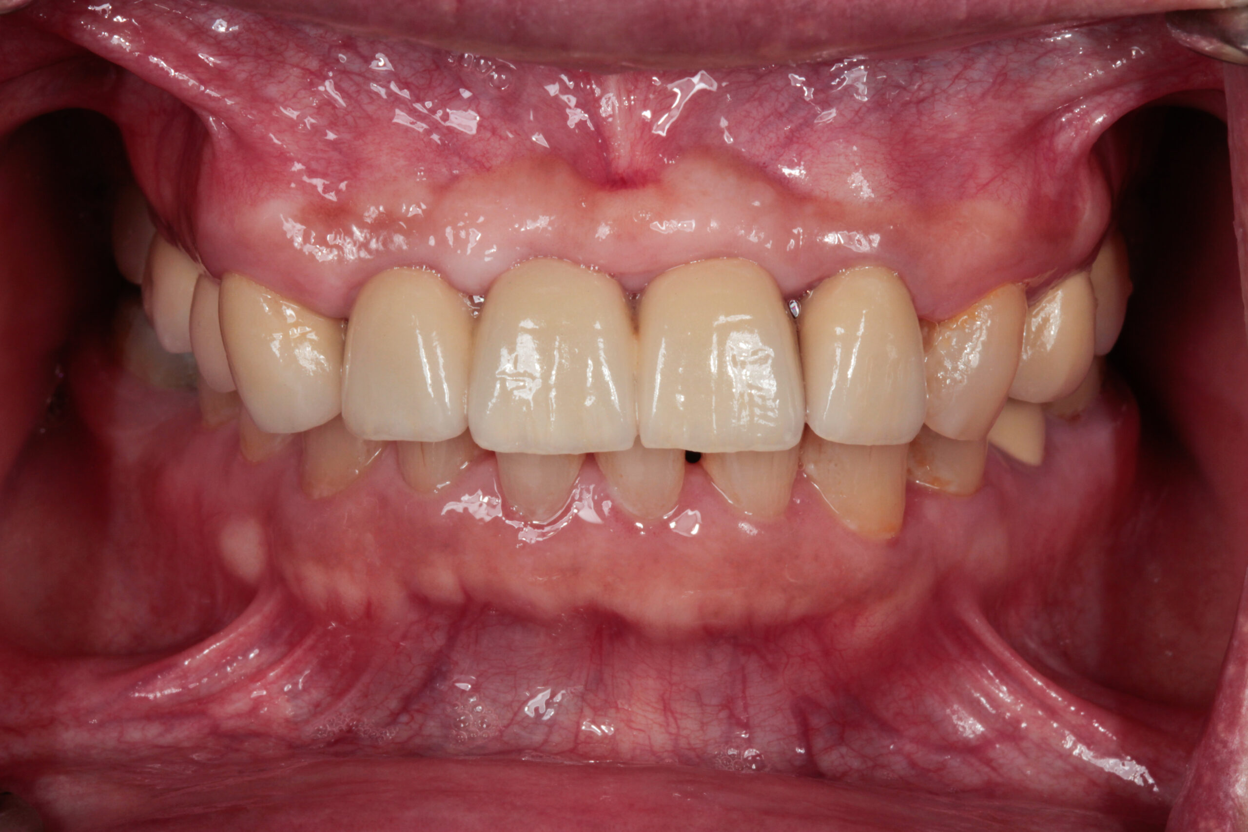 After image