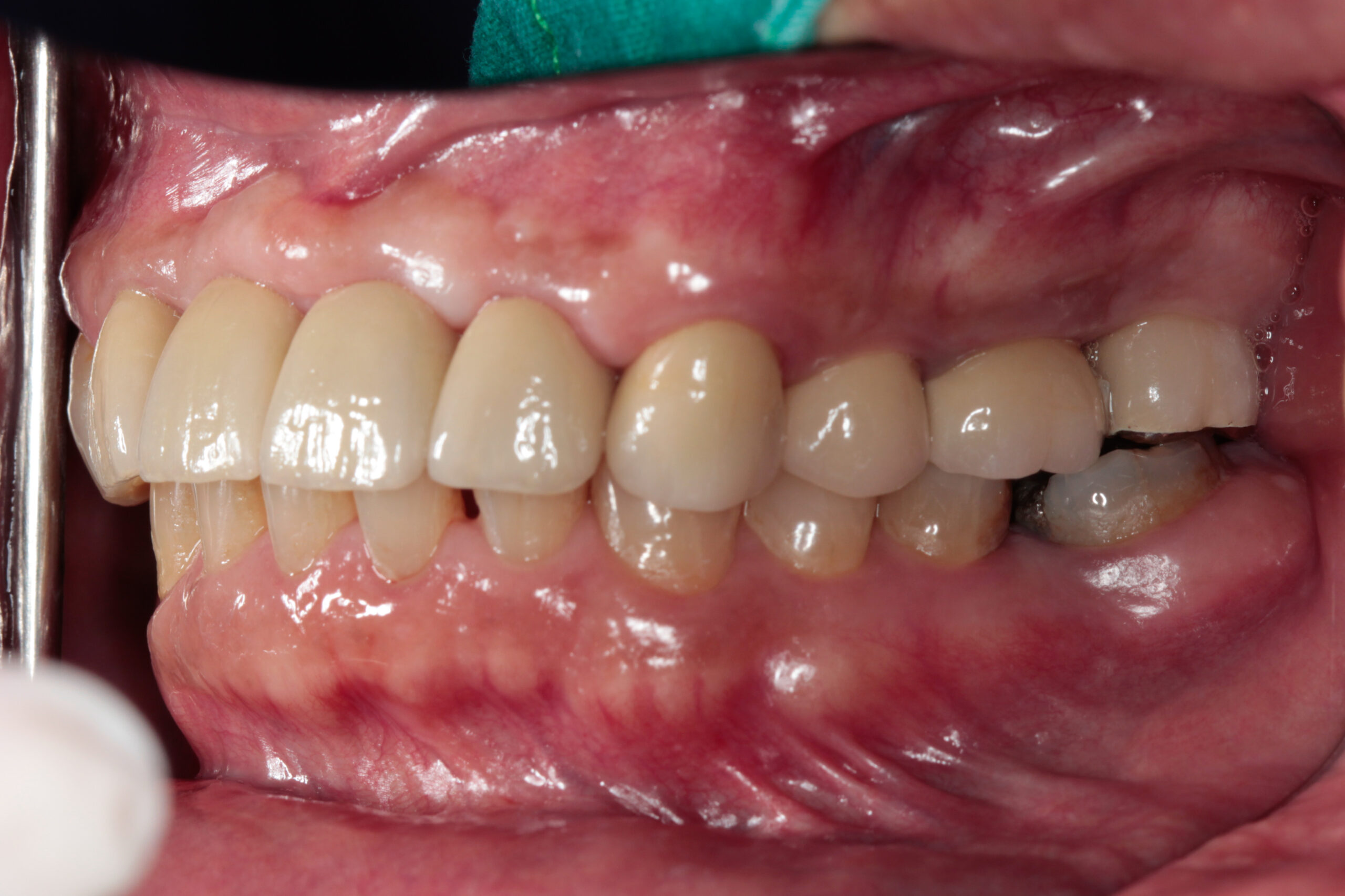 After image