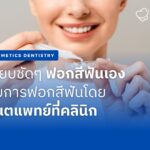 ฟอกสีฟันที่บ้าน vs. ที่คลินิก