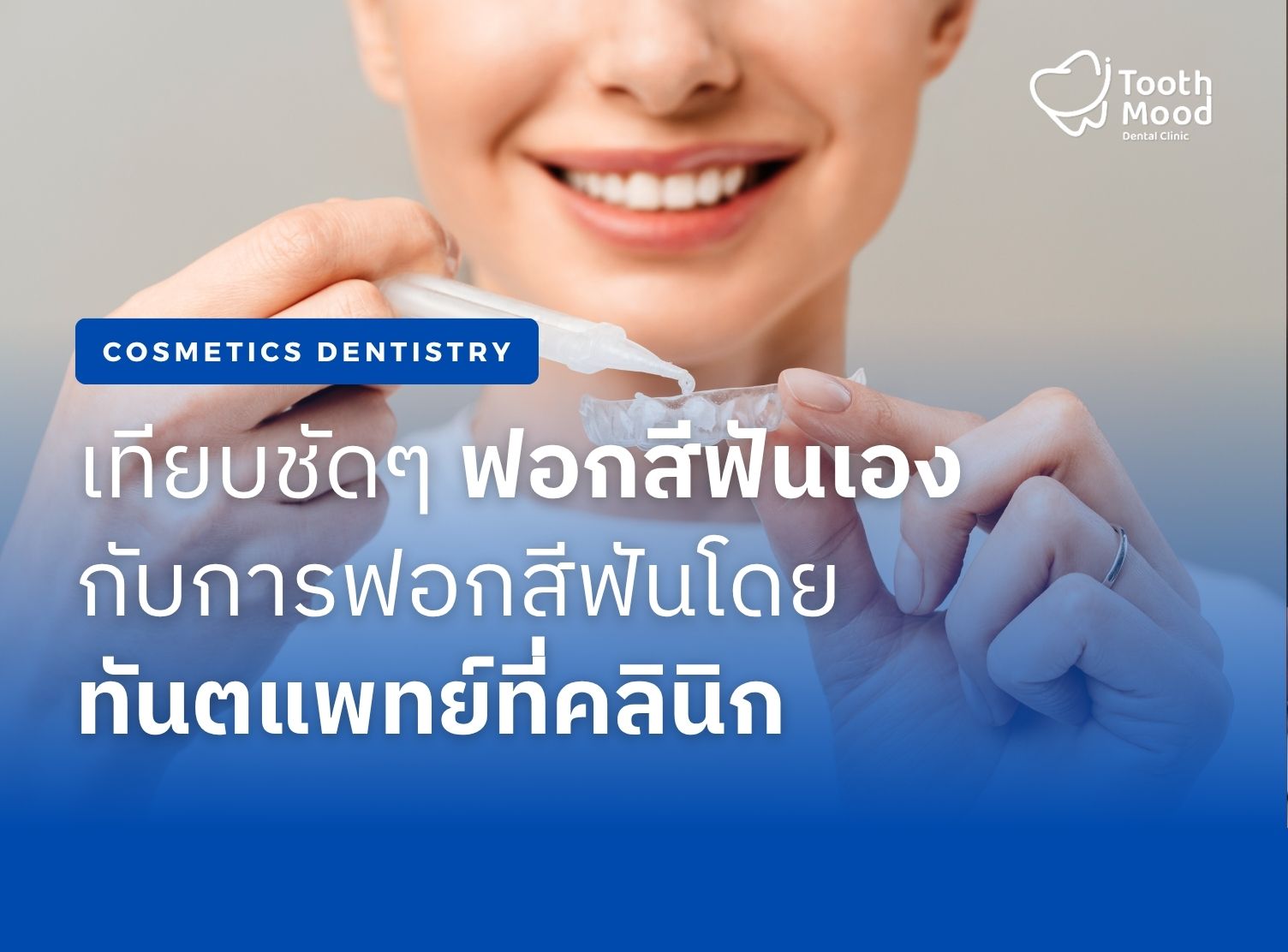 ฟอกสีฟันที่บ้าน vs. ที่คลินิก