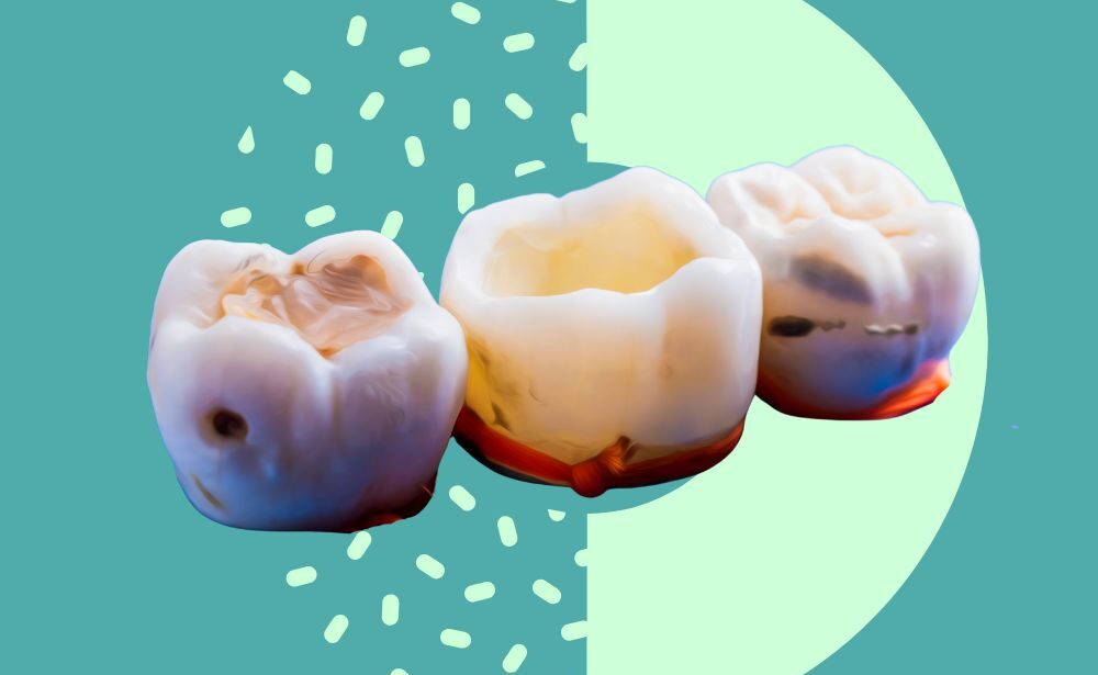 dental filling icon