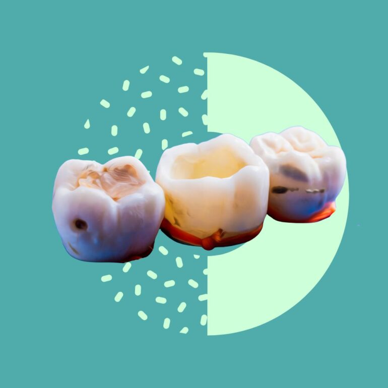 dental filling icon