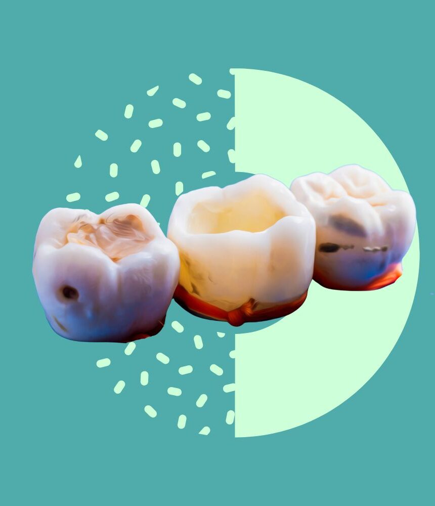 dental filling icon